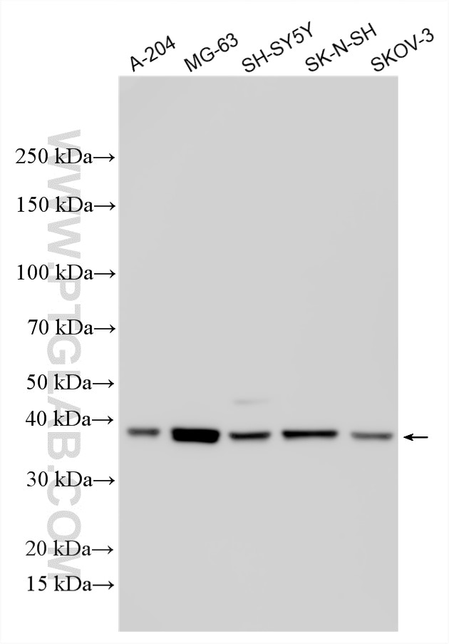 Western Blot (WB) analysis of various lysates using RP11-45B20.2 Polyclonal antibody (34185-1-AP)
