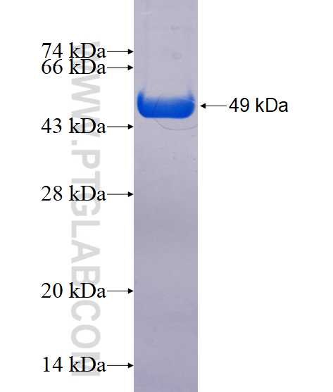 RP11-529I10.4 fusion protein Ag15029 SDS-PAGE