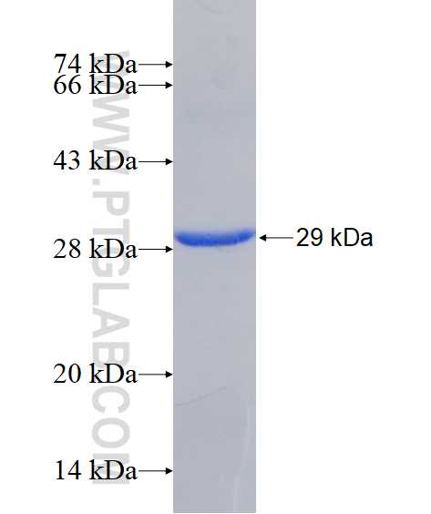 RP11-529I10.4 fusion protein Ag15442 SDS-PAGE