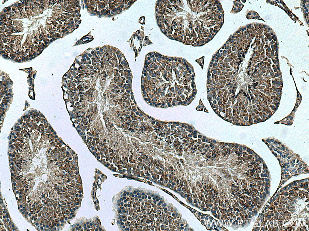 Immunohistochemistry (IHC) staining of mouse testis tissue using DPCD Polyclonal antibody (20936-1-AP)