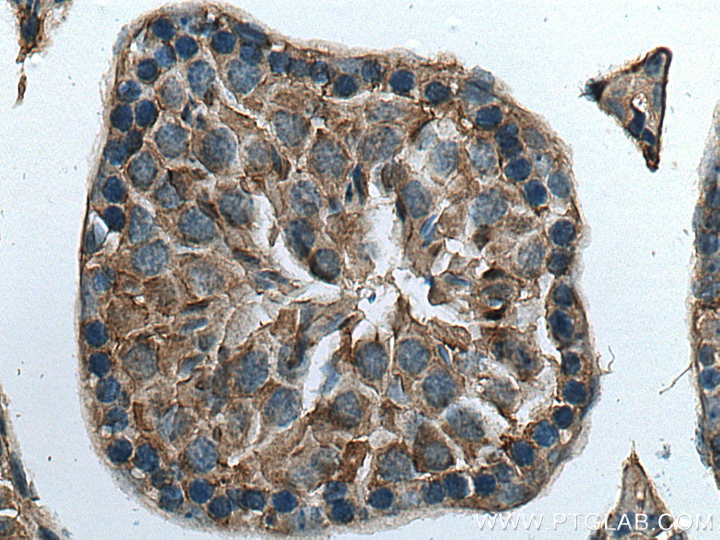 IHC staining of mouse testis using 20936-1-AP