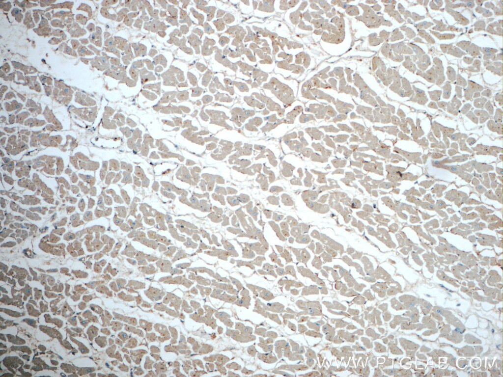 Immunohistochemistry (IHC) staining of human heart tissue using DPCD Polyclonal antibody (20936-1-AP)
