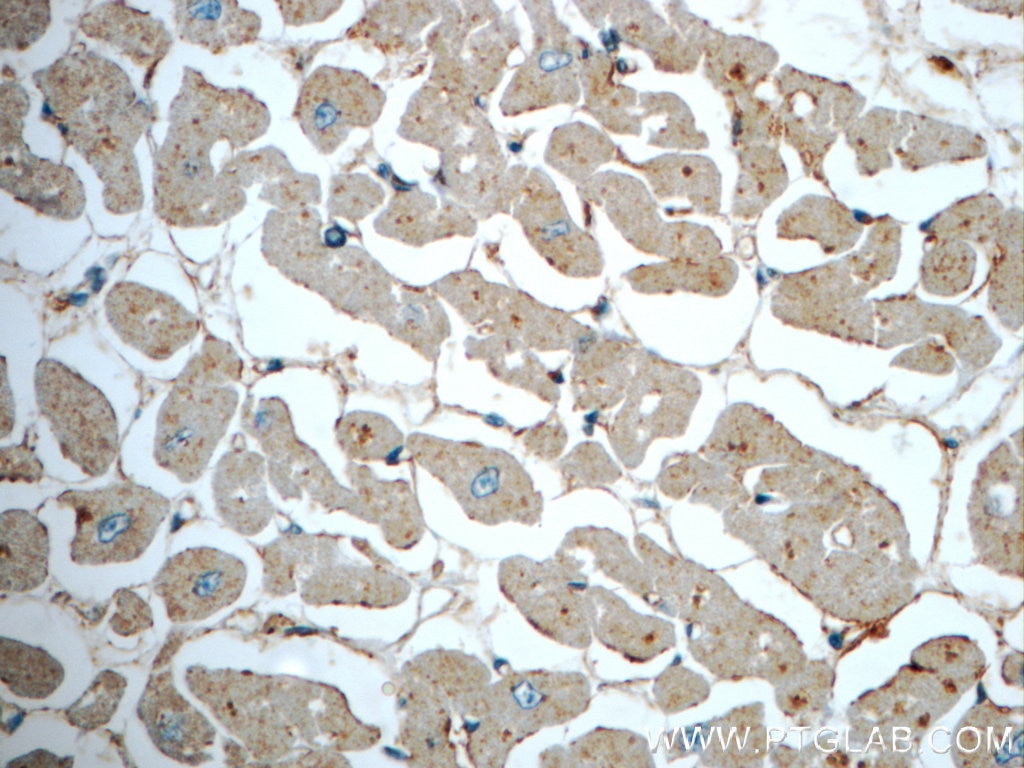 Immunohistochemistry (IHC) staining of human heart tissue using DPCD Polyclonal antibody (20936-1-AP)