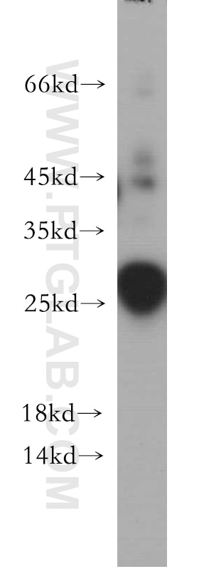 WB analysis of human testis using 20936-1-AP