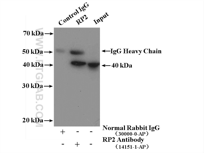 Immunoprecipitation (IP) experiment of Y79 cells using RP2 Polyclonal antibody (14151-1-AP)