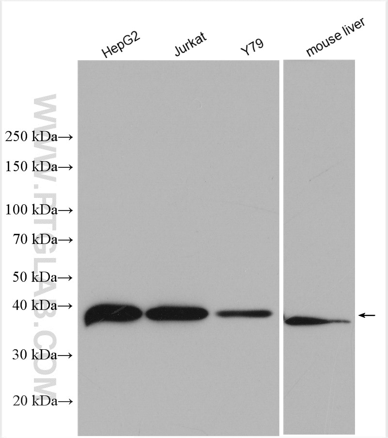 Western Blot (WB) analysis of various lysates using RP2 Polyclonal antibody (14151-1-AP)
