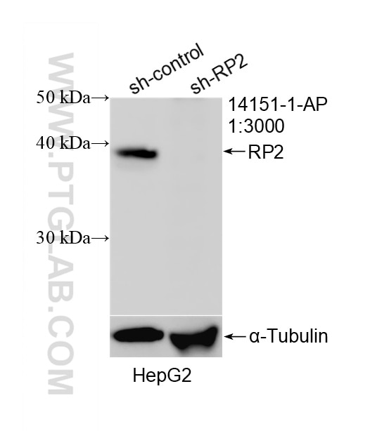 Western Blot (WB) analysis of various lysates using RP2 Polyclonal antibody (14151-1-AP)