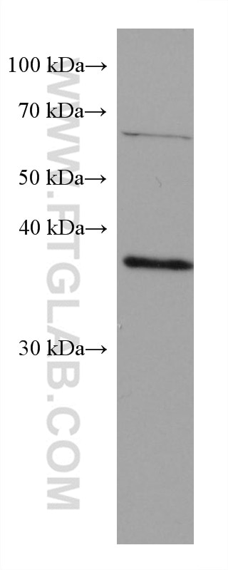 Western Blot (WB) analysis of HeLa cells using RP2 Monoclonal antibody (67795-1-Ig)