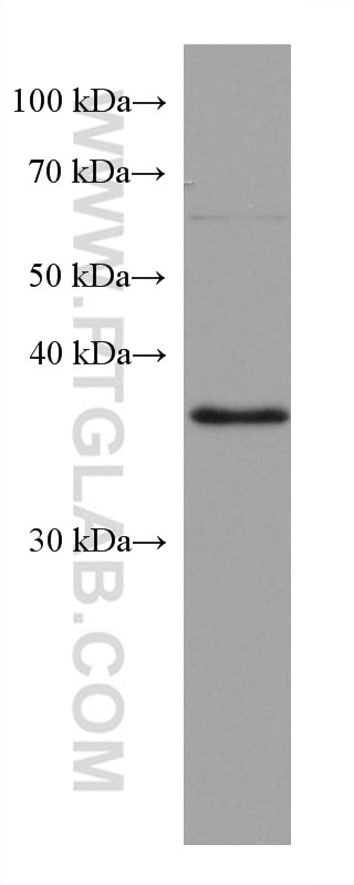 Western Blot (WB) analysis of HepG2 cells using RP2 Monoclonal antibody (67795-1-Ig)