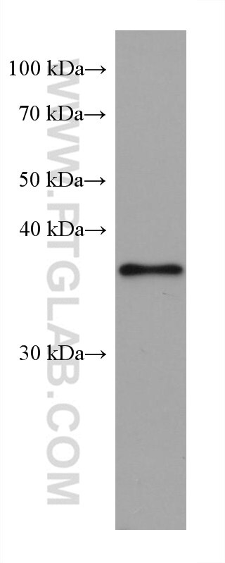 Western Blot (WB) analysis of Y79 cells using RP2 Monoclonal antibody (67795-1-Ig)
