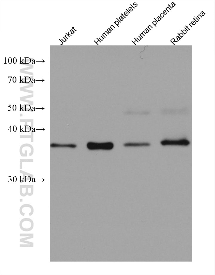 Western Blot (WB) analysis of various lysates using RP2 Monoclonal antibody (67795-1-Ig)