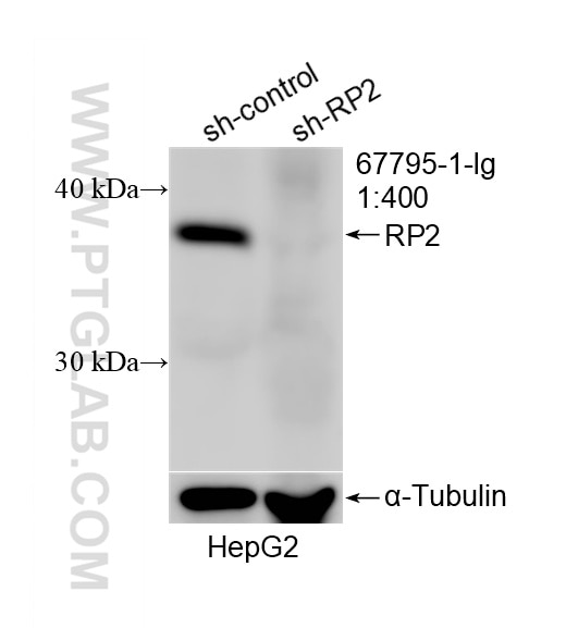 WB analysis of HepG2 using 67795-1-Ig Western Blot (WB) analysis of HepG2 cells using RP2 Monoclonal antibody (67795-1-Ig)