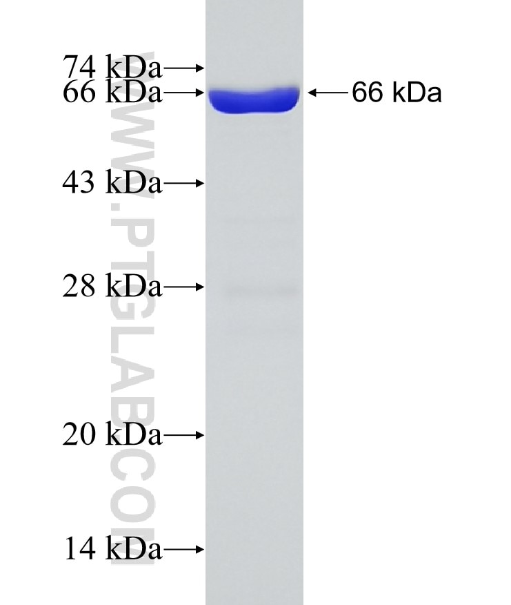 RP2 fusion protein Ag5332 SDS-PAGE