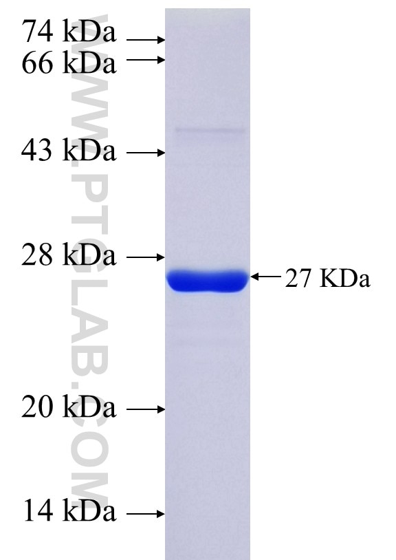 RP3-402G11.5 fusion protein Ag35979 SDS-PAGE