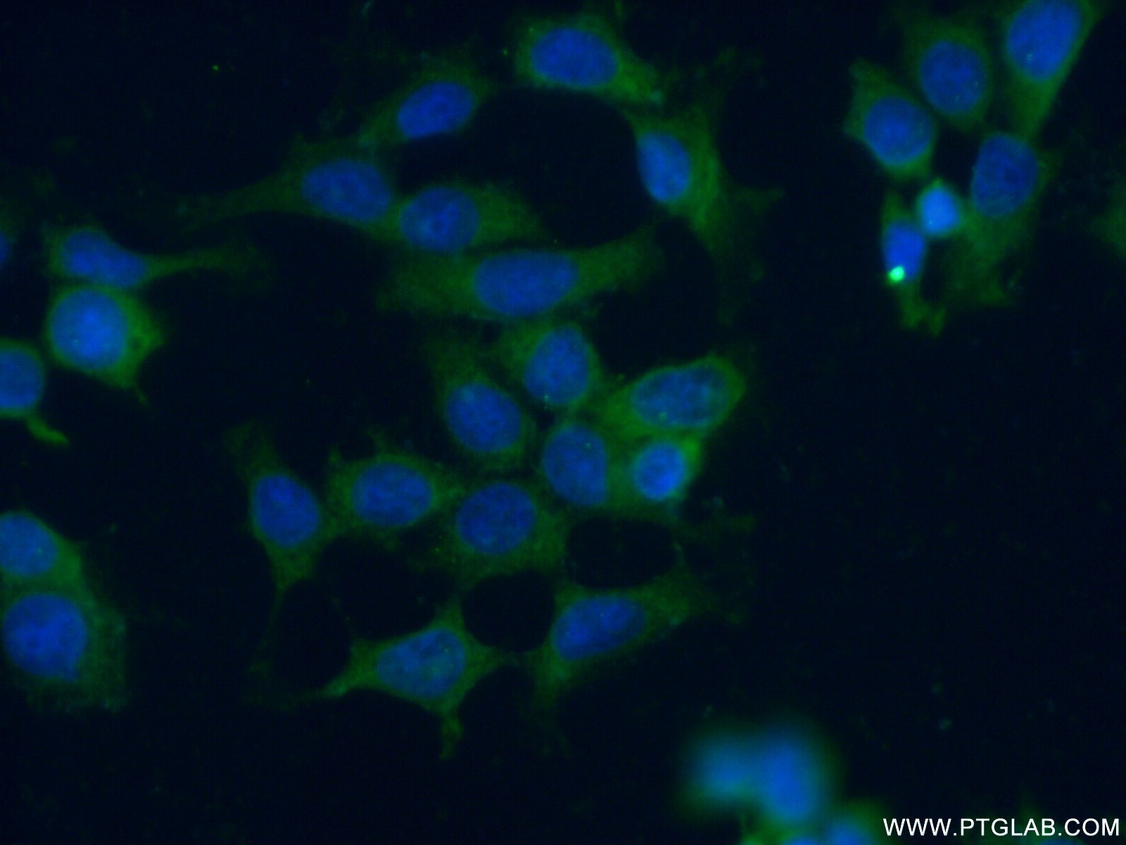 Immunofluorescence (IF) / fluorescent staining of MCF-7 cells using MST4 Polyclonal antibody (10847-1-AP)