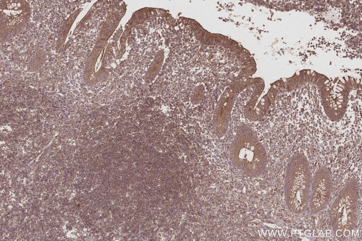 Immunohistochemistry (IHC) staining of human appendicitis tissue using MST4 Polyclonal antibody (10847-1-AP)
