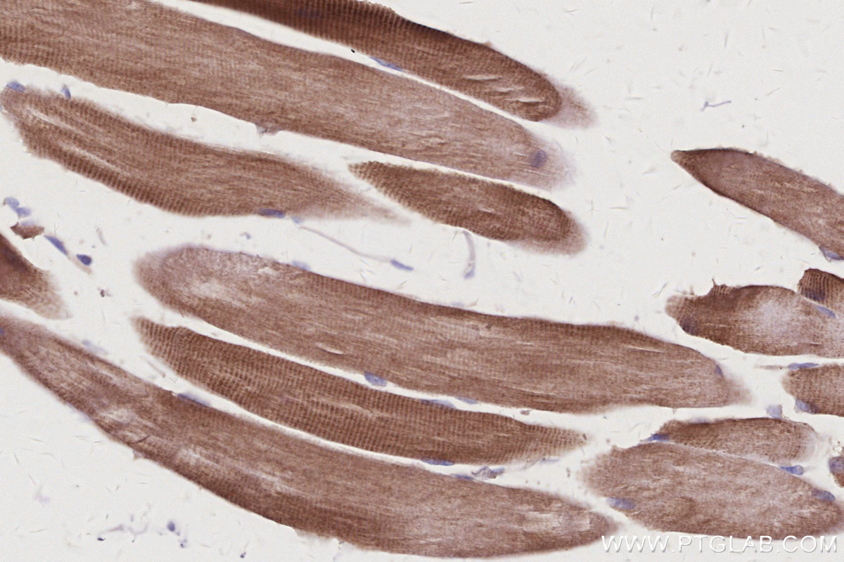 Immunohistochemistry (IHC) staining of mouse skeletal muscle tissue using MST4 Polyclonal antibody (10847-1-AP)