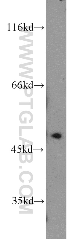Western Blot (WB) analysis of Jurkat cells using MST4 Polyclonal antibody (10847-1-AP)