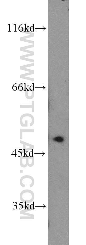 WB analysis of Jurkat using 10847-1-AP