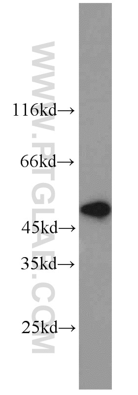 Western Blot (WB) analysis of HL-60 cells using MST4 Polyclonal antibody (10847-1-AP)