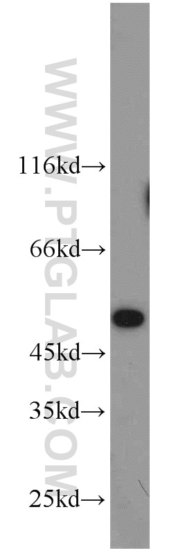 Western Blot (WB) analysis of MCF-7 cells using MST4 Polyclonal antibody (10847-1-AP)