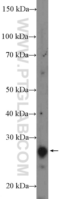 Western Blot (WB) analysis of mouse brain tissue using RP9 Polyclonal antibody (16832-1-AP)