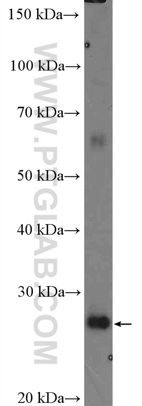Western Blot (WB) analysis of HeLa cells using RP9 Polyclonal antibody (16832-1-AP)