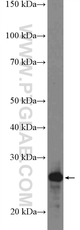 Western Blot (WB) analysis of HepG2 cells using RP9 Polyclonal antibody (16832-1-AP)