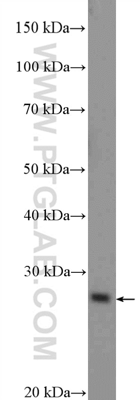 Western Blot (WB) analysis of MCF-7 cells using RP9 Polyclonal antibody (16832-1-AP)