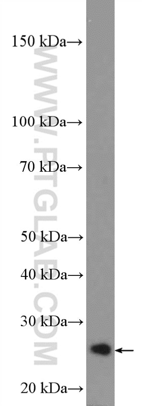 Western Blot (WB) analysis of HeLa cells using RP9 Polyclonal antibody (16832-1-AP)