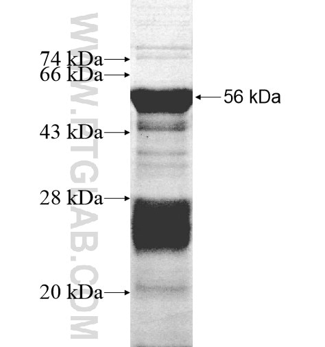 RP9 fusion protein Ag10441 SDS-PAGE