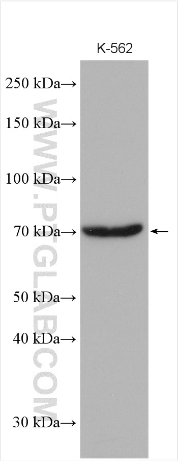 Western Blot (WB) analysis of various lysates using RPA1 Polyclonal antibody (12448-1-AP)
