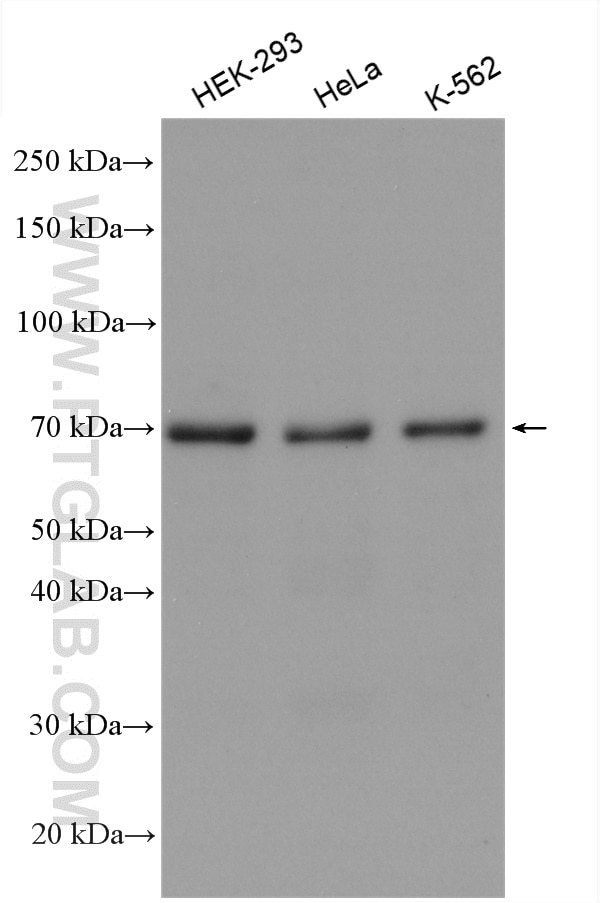 Western Blot (WB) analysis of various lysates using RPA1 Polyclonal antibody (12448-1-AP)