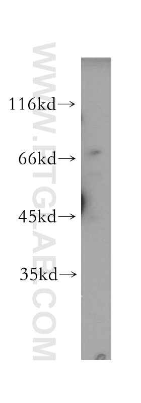 Western Blot (WB) analysis of Y79 cells using RPA1 Polyclonal antibody (12448-1-AP)