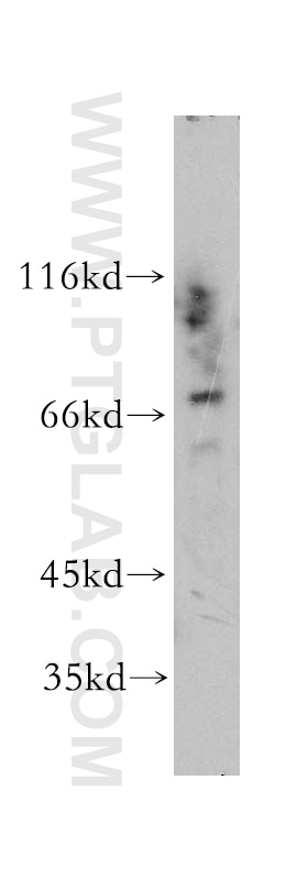 Western Blot (WB) analysis of Y79 cells using RPA1 Polyclonal antibody (12448-1-AP)