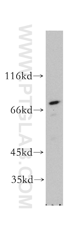 Western Blot (WB) analysis of A431 cells using RPA1 Polyclonal antibody (12448-1-AP)
