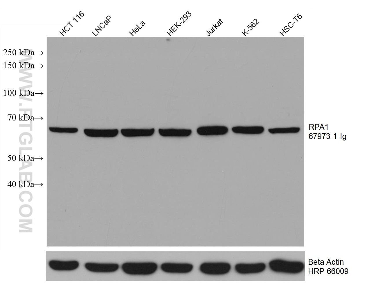 Western Blot (WB) analysis of various lysates using RPA1 Monoclonal antibody (67973-1-Ig)