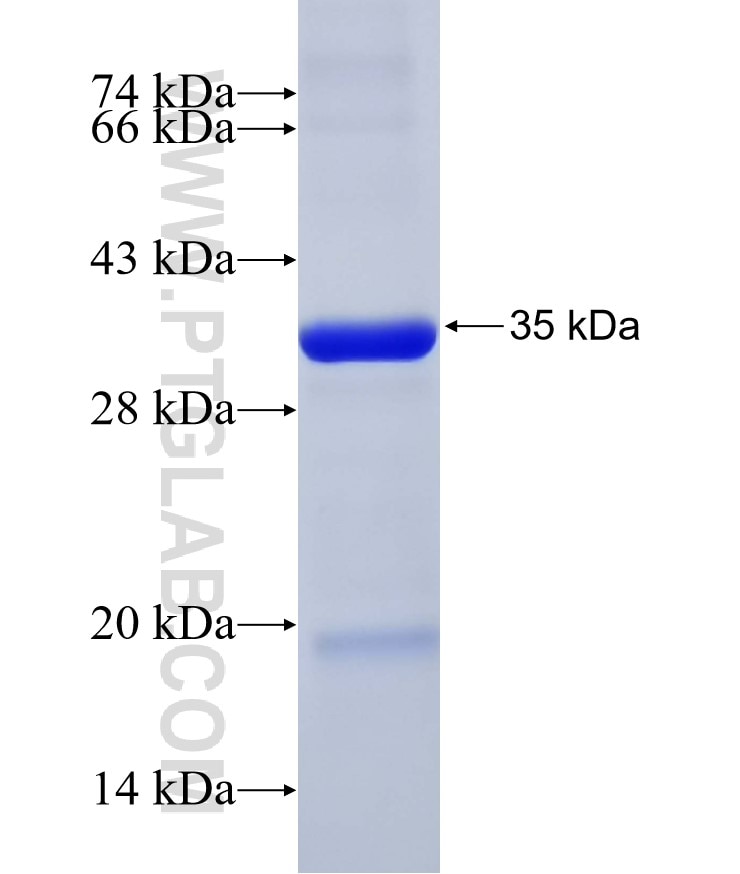 RPA1 fusion protein Ag26441 SDS-PAGE