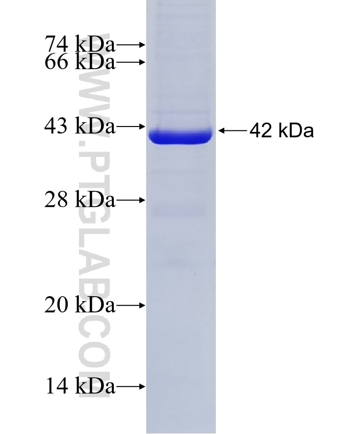 RPA1 fusion protein Ag28239 SDS-PAGE