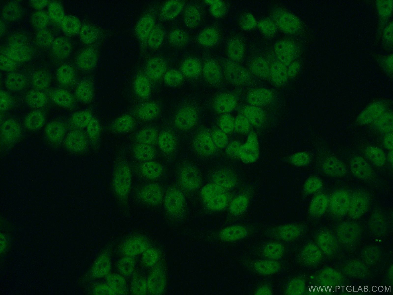 Immunofluorescence (IF) / fluorescent staining of HeLa cells using RPA2 Polyclonal antibody (10412-1-Ap)