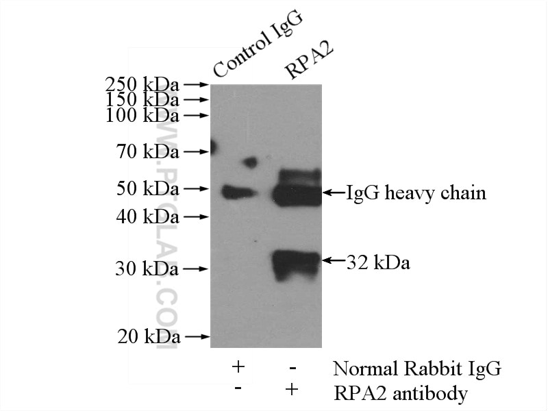 Immunoprecipitation (IP) experiment of mouse kidney tissue using RPA2 Polyclonal antibody (10412-1-Ap)
