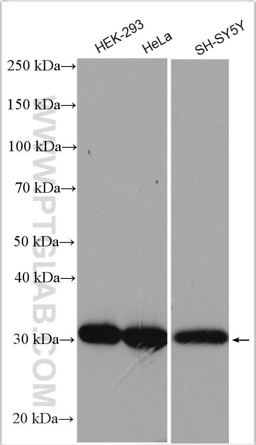 Western Blot (WB) analysis of various lysates using RPA2 Polyclonal antibody (10412-1-Ap)