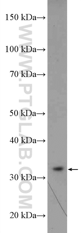 Western Blot (WB) analysis of mouse brain tissue using RPA2 Polyclonal antibody (10412-1-Ap)