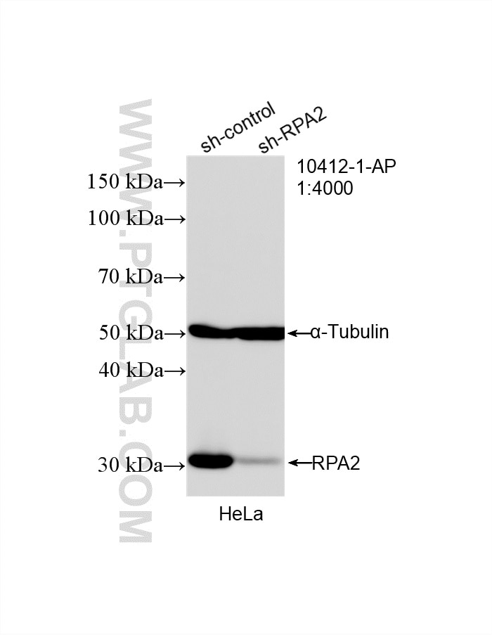 Western Blot (WB) analysis of HeLa cells using RPA2 Polyclonal antibody (10412-1-Ap)