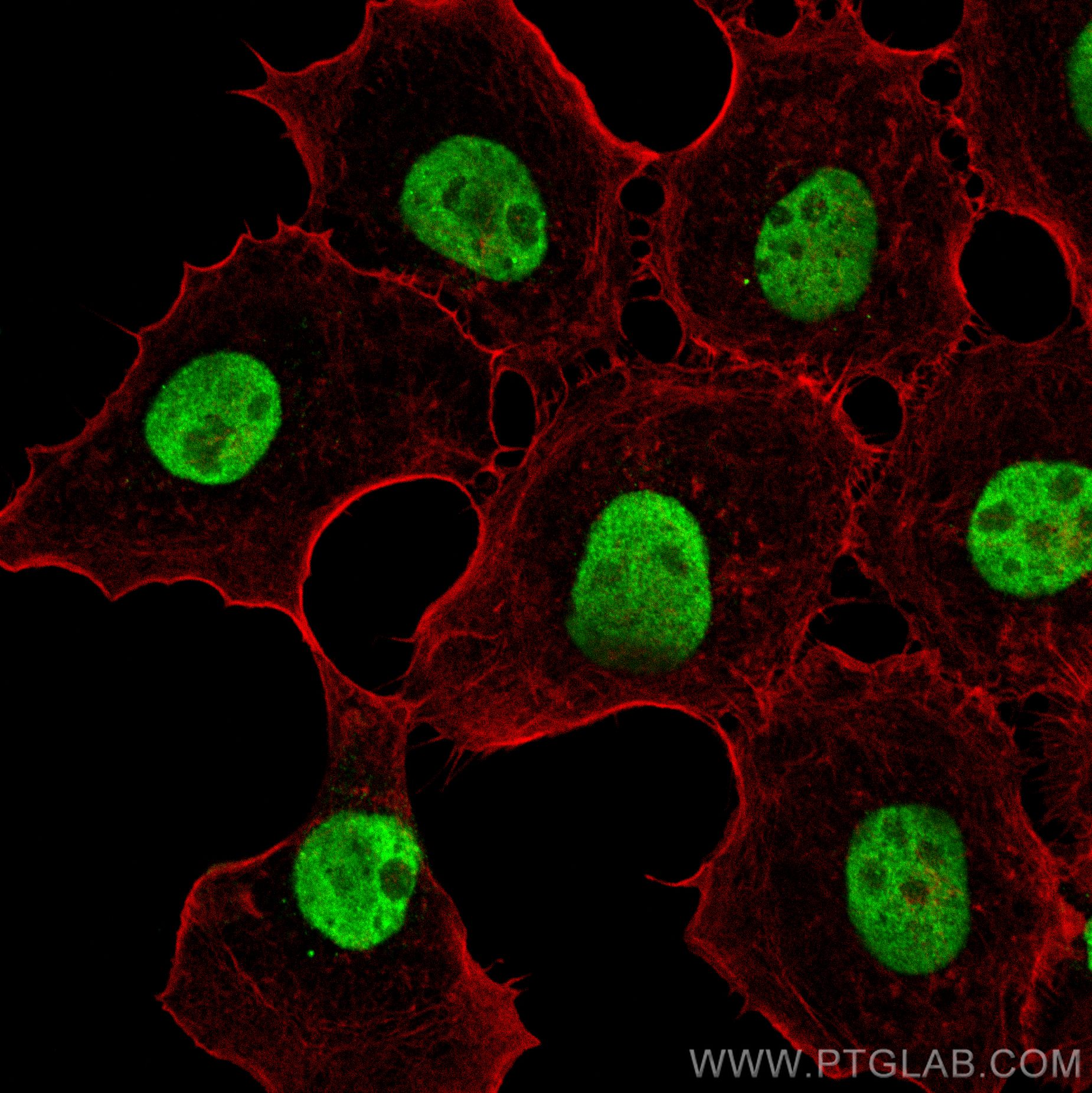Immunofluorescence (IF) / fluorescent staining of A431 cells using RPA2 Monoclonal antibody (67999-1-Ig)