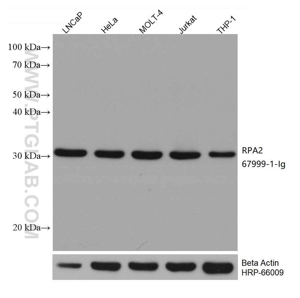 Western Blot (WB) analysis of various lysates using RPA2 Monoclonal antibody (67999-1-Ig)