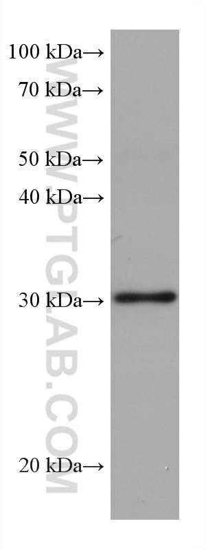 Western Blot (WB) analysis of pig spleen tissue using RPA2 Monoclonal antibody (67999-1-Ig)