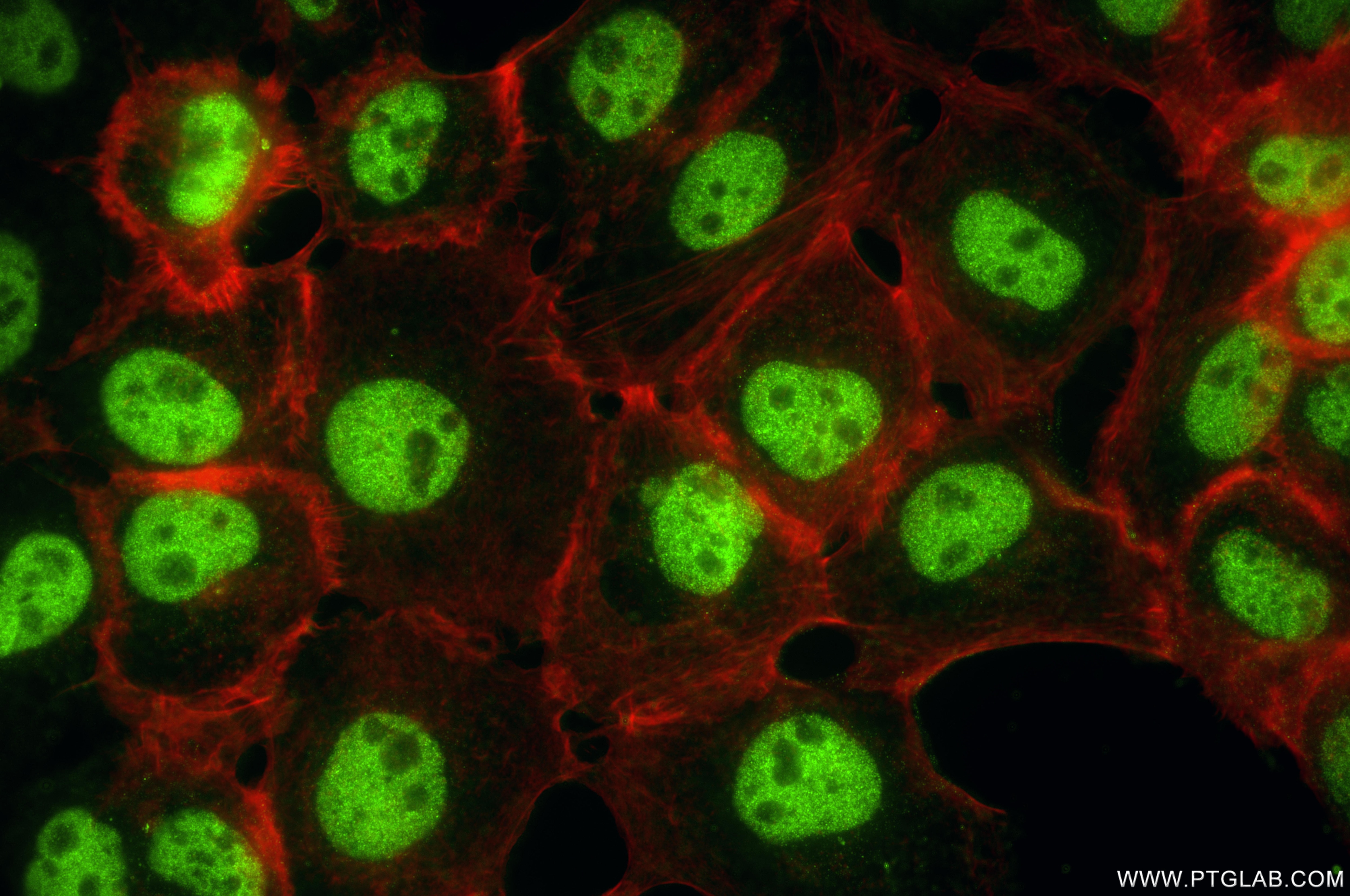IF Staining of A431 using 87254-1-RR Immunofluorescence (IF) / fluorescent staining of A431 cells using RPA2 Recombinant monoclonal antibody (87254-1-RR)