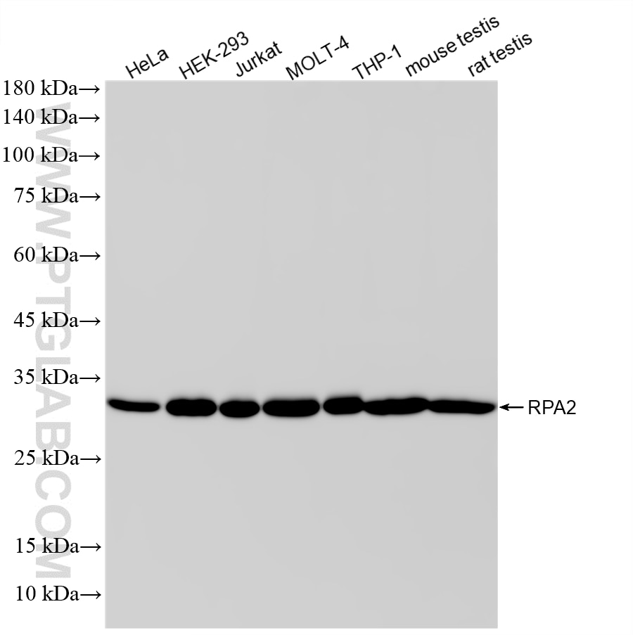WB analysis using 87254-1-RR Western Blot (WB) analysis of various lysates using RPA2 Recombinant monoclonal antibody (87254-1-RR)