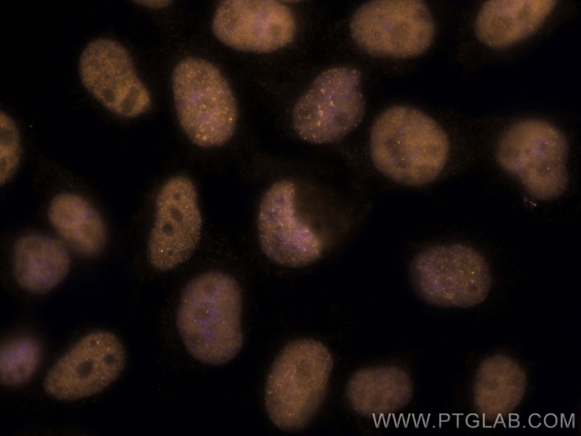 Immunofluorescence (IF) / fluorescent staining of A431 cells using CoraLite®555-conjugated RPA2 Monoclonal antibody (CL555-67999)